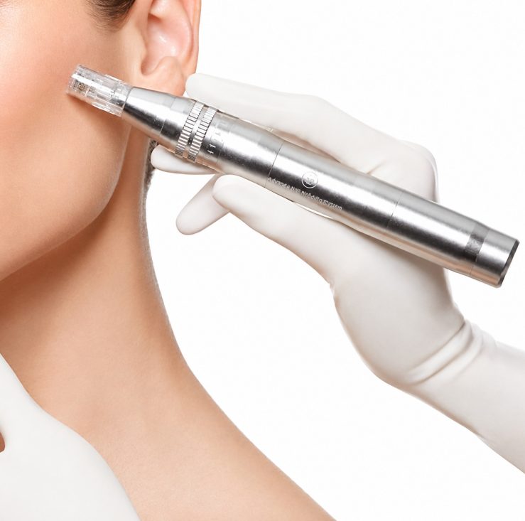 dermapen